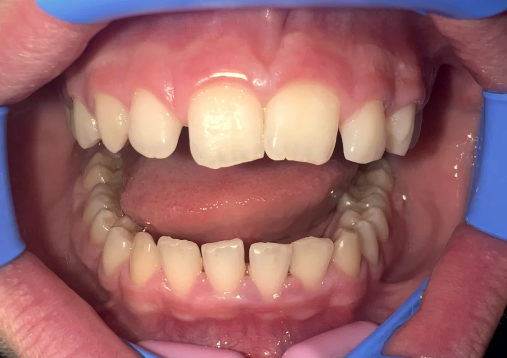 Case 1