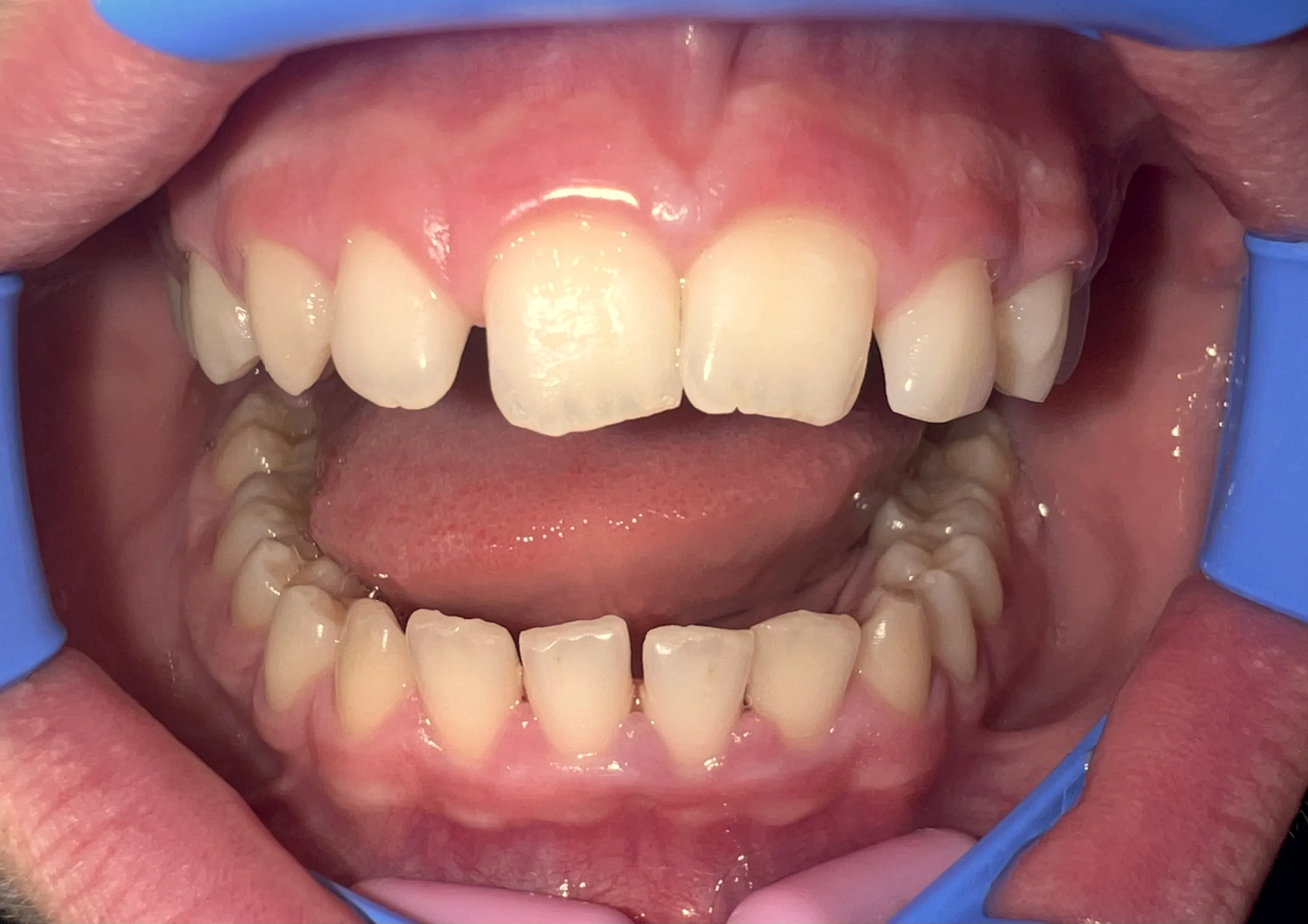Case 1
